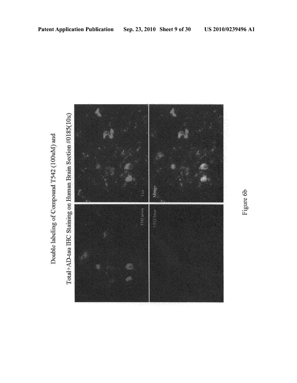 Imaging agents for detecting neurological disorders - diagram, schematic, and image 10