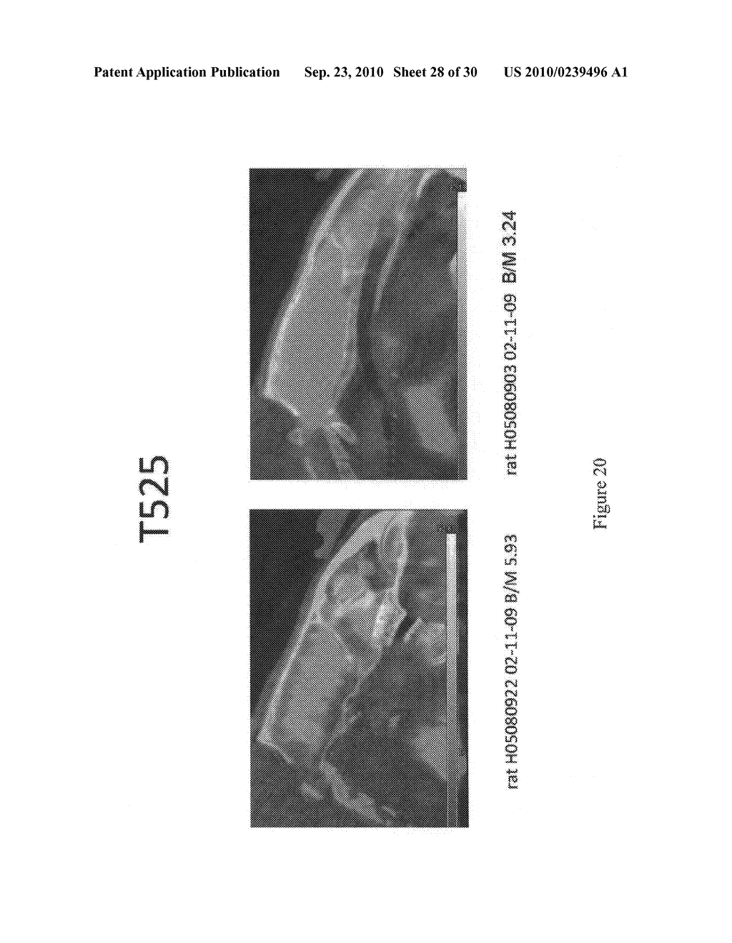 Imaging agents for detecting neurological disorders - diagram, schematic, and image 29