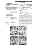 SURFACE MODIFIED AEROSOL PARTICLES, A METHOD AND APPARATUS FOR PRODUCTION THEREOF AND POWDERS AND DISPERSIONS CONTAINING SAID PARTICLES diagram and image