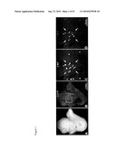 COMPOSITIONS COMPRISING VASCULAR AND MYOCYTE PROGENITOR CELLS AND METHODS OF THEIR USE diagram and image