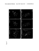 COMPOSITIONS COMPRISING VASCULAR AND MYOCYTE PROGENITOR CELLS AND METHODS OF THEIR USE diagram and image