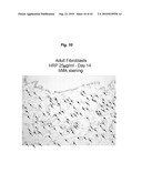 PROMOTING ECM PRODUCTION BY FIBROBLAST CELLS AND/OR PROMOTING MIGRATION OF FIBROBLAST CELLS IN A BIOLOGICAL SYSTEM diagram and image