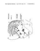 Lipid Hydrolysis Therapy for Atherosclerosis and Related Diseases diagram and image