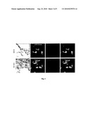 MONCOLONAL AMYLOID BETA (ABETA) - SPECIFIC ANTIBODY AND USES THEREOF diagram and image