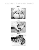 LAYER SILICATE NANOCOMPOSITES OF POLYMER HYDROGELS AND THEIR USE IN TISSUE EXPANDERS diagram and image