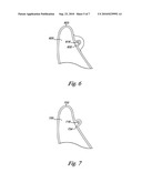 DENTAL WIRE ATTACHMENT diagram and image