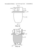 ORAL IRRIGATOR APPLIANCE WITH RADIANT ENERGY DELIVERY FOR BACTERICIDAL EFFECT diagram and image