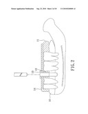 METHOD OF MAKING A SURGICAL TEMPLATE USED FOR A COMPUTER-GUIDED DENTAL IMPLANT SURGERY diagram and image