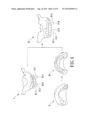 METHOD OF MAKING A SURGICAL TEMPLATE USED FOR A COMPUTER-GUIDED DENTAL IMPLANT SURGERY diagram and image