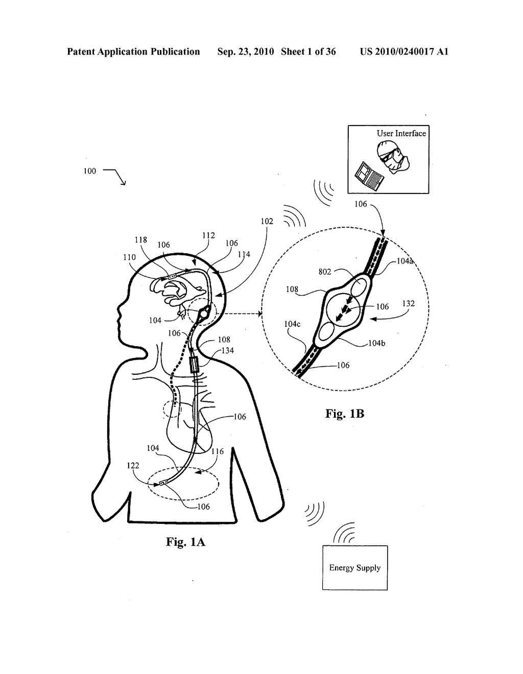 Systems, devices, and methods including infection-fighting and monitoring shunts - diagram, schematic, and image 02