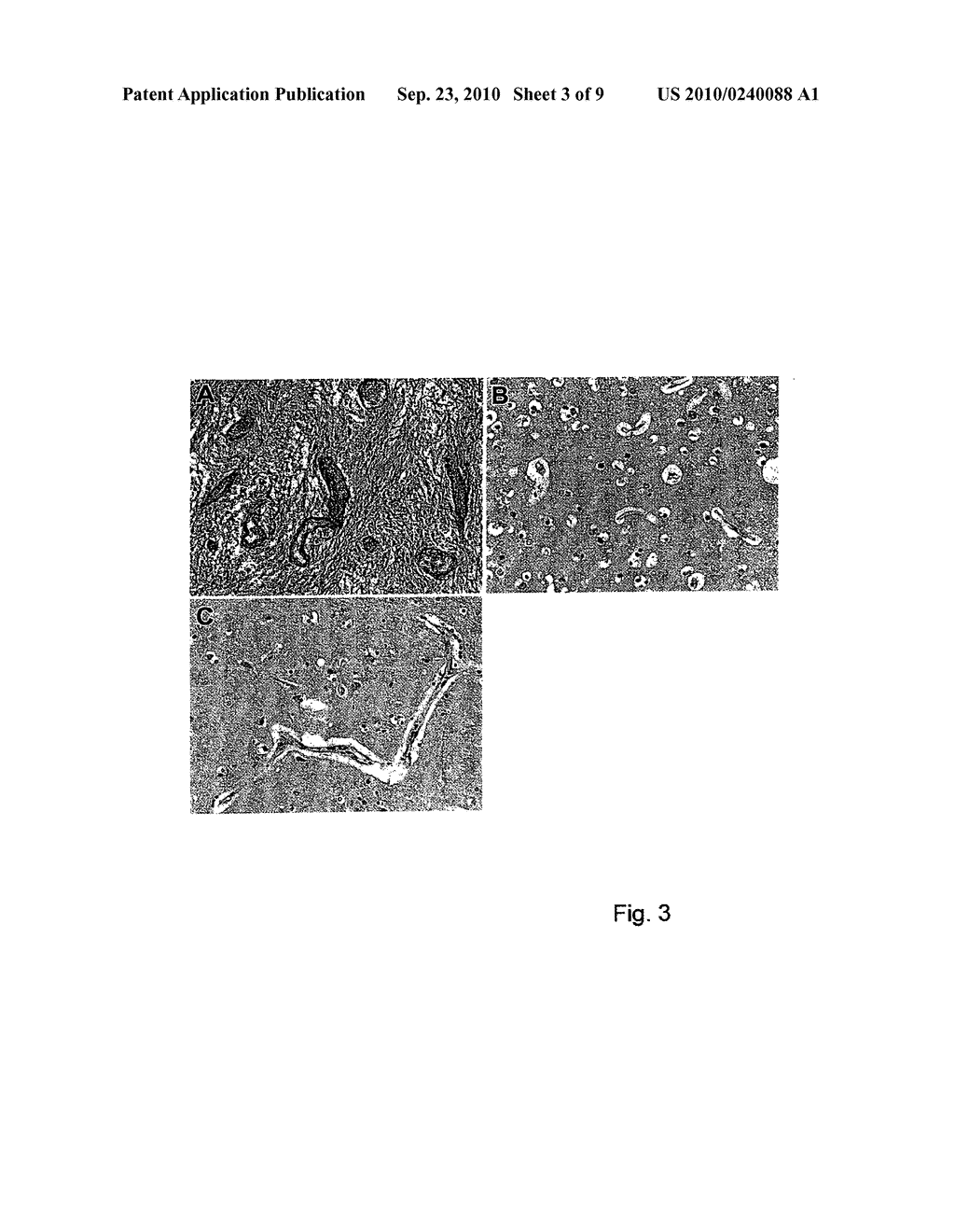 Peptide Markers for Diagnosis of Angiogenesis - diagram, schematic, and image 04