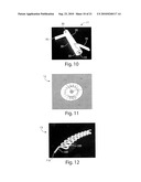 THREE DIMENSIONAL FABRICATION OF BIOCOMPATIBLE STRUCTURES IN ANATOMICAL SHAPES AND DIMENSIONS FOR TISSUE ENGINEERING AND ORGAN REPLACEMENT diagram and image