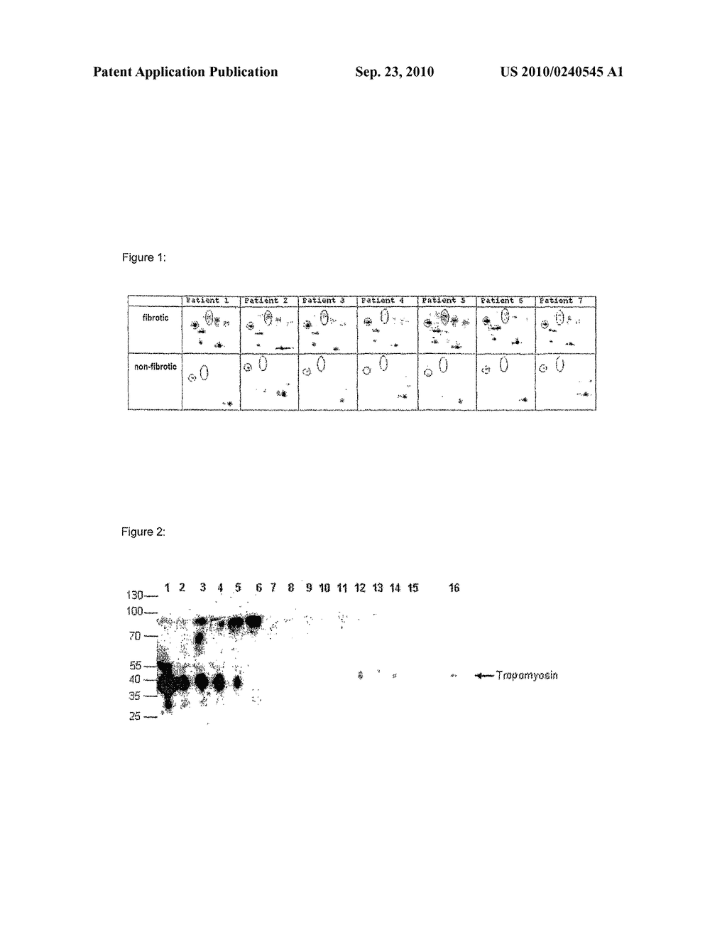 BIOMARKERS FOR INFLAMMATION OF THE LIVER - diagram, schematic, and image 02