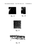 ANTI-ANGIOGENIC COMPOSITIONS AND METHODS OF USE diagram and image