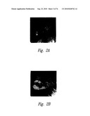 ANTI-ANGIOGENIC COMPOSITIONS AND METHODS OF USE diagram and image