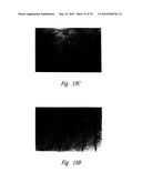 ANTI-ANGIOGENIC COMPOSITIONS AND METHODS OF USE diagram and image