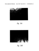 ANTI-ANGIOGENIC COMPOSITIONS AND METHODS OF USE diagram and image