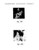 ANTI-ANGIOGENIC COMPOSITIONS AND METHODS OF USE diagram and image