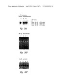 ANTI-ANGIOGENIC COMPOSITIONS AND METHODS OF USE diagram and image