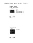 ANTI-ANGIOGENIC COMPOSITIONS AND METHODS OF USE diagram and image