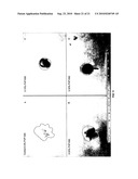 ANESTHETIC SPRAY COMPOSITION diagram and image