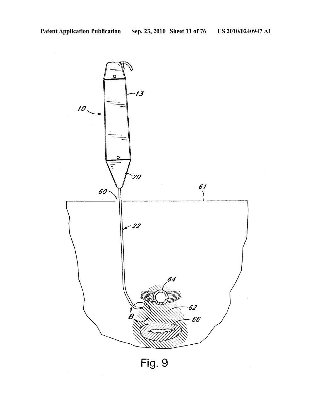 DEVICES FOR MINIMALLY INVASIVE PELVIC SURGERY - diagram, schematic, and image 12