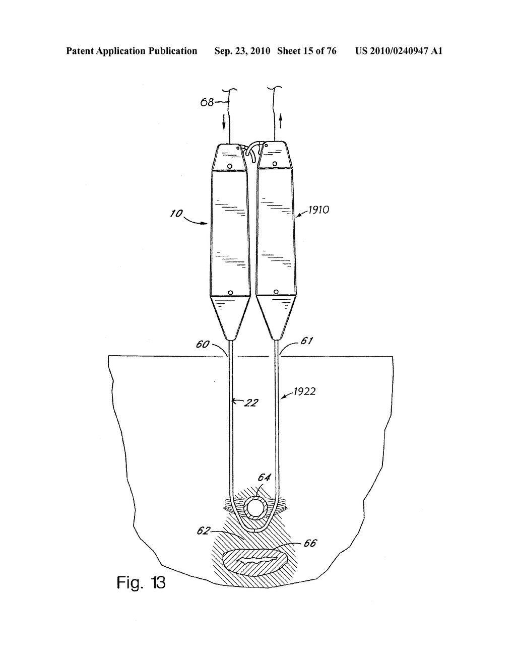 DEVICES FOR MINIMALLY INVASIVE PELVIC SURGERY - diagram, schematic, and image 16