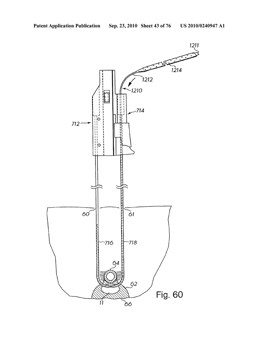 DEVICES FOR MINIMALLY INVASIVE PELVIC SURGERY - diagram, schematic, and image 44