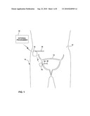 TRANSMEMBRANE SENSING DEVICE FOR SENSING BLADDER CONDITION diagram and image