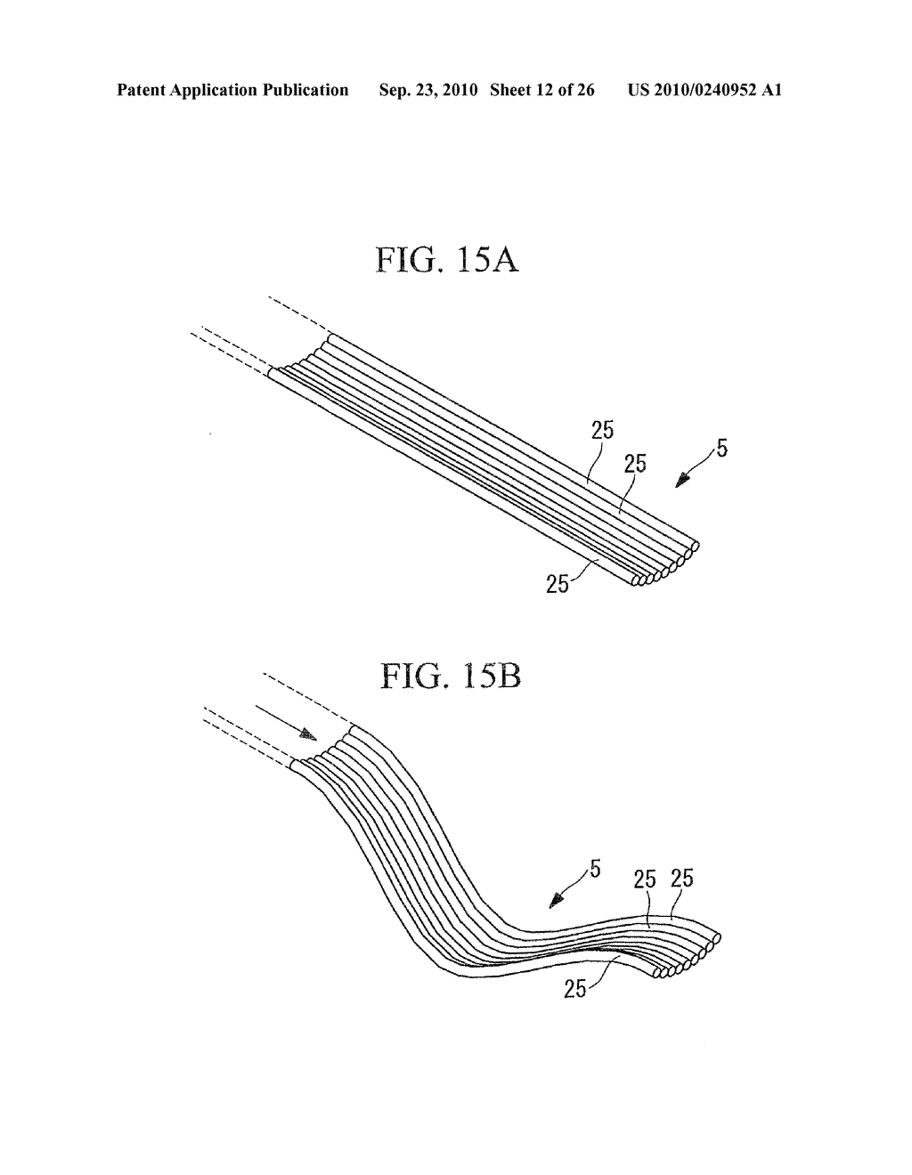 ENDOSCOPY METHOD AND ENDOSCOPE - diagram, schematic, and image 13