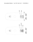 SYSTEM AND METHOD FOR DETERMINING A TREATMENT DOSE FOR A PATIENT diagram and image