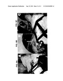 ROBOT FOR COMPUTED TOMOGRAPHY INTERVENTIONS diagram and image