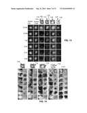 SYSTEM AND METHOD FOR TREATING TUMORS diagram and image