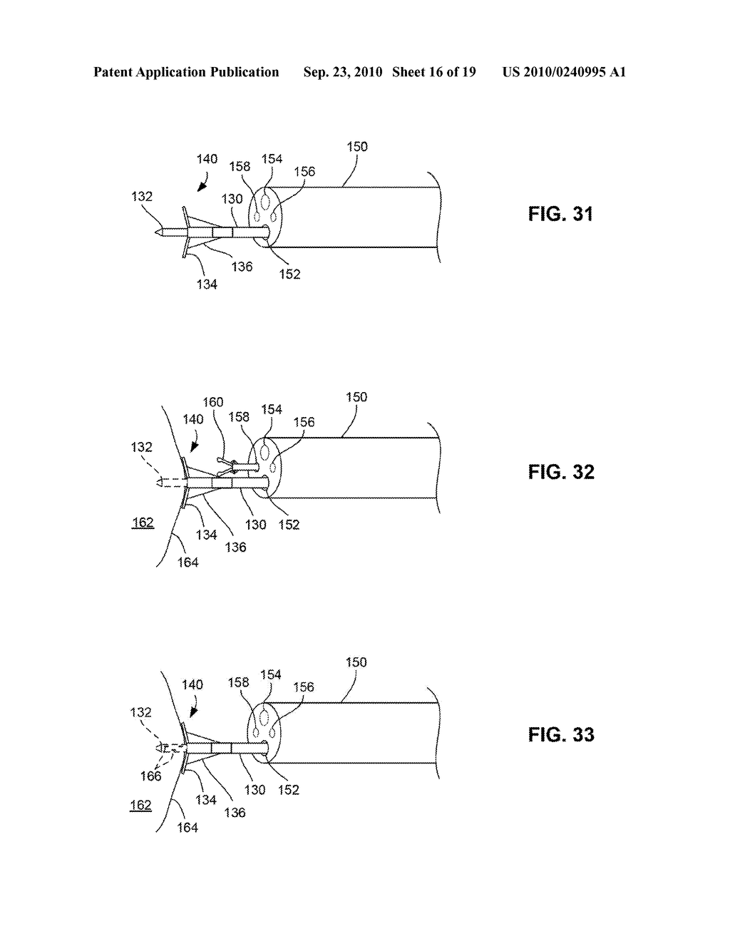 SYSTEM AND METHOD FOR TREATING TUMORS - diagram, schematic, and image 17