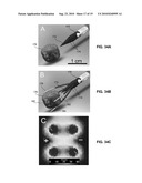 SYSTEM AND METHOD FOR TREATING TUMORS diagram and image