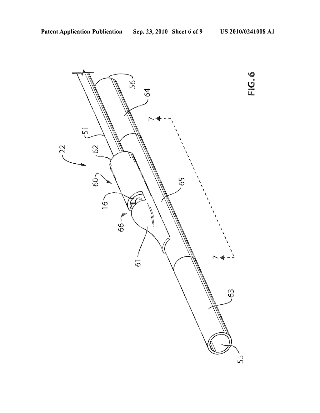 ECCENTRIC PRESSURE CATHETER WITH GUIDEWIRE COMPATIBILITY - diagram, schematic, and image 07