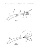 Navigable Tissue Treatment Tools diagram and image