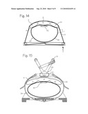 CPR Compression Device and Method diagram and image