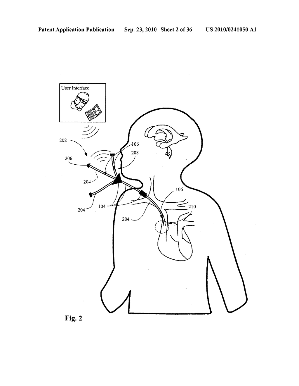 Systems, devices, and methods including infection-fighting and monitoring shunts - diagram, schematic, and image 03