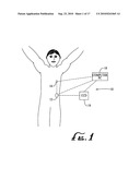 Infusion Device with Base Portion and Durable Portion diagram and image