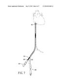 Vascular cannula assembly with an improved structure for confining blood flow diagram and image