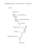 INTRAMEDULLARY NAIL DEVICE AND METHOD FOR REPAIRING LONG BONE diagram and image