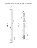 FLEXIBLE INTRAMEDULLARY ROD diagram and image