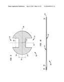 FLEXIBLE INTRAMEDULLARY ROD diagram and image