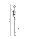 FLEXIBLE INTRAMEDULLARY ROD diagram and image