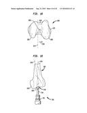 FLEXIBLE INTRAMEDULLARY ROD diagram and image