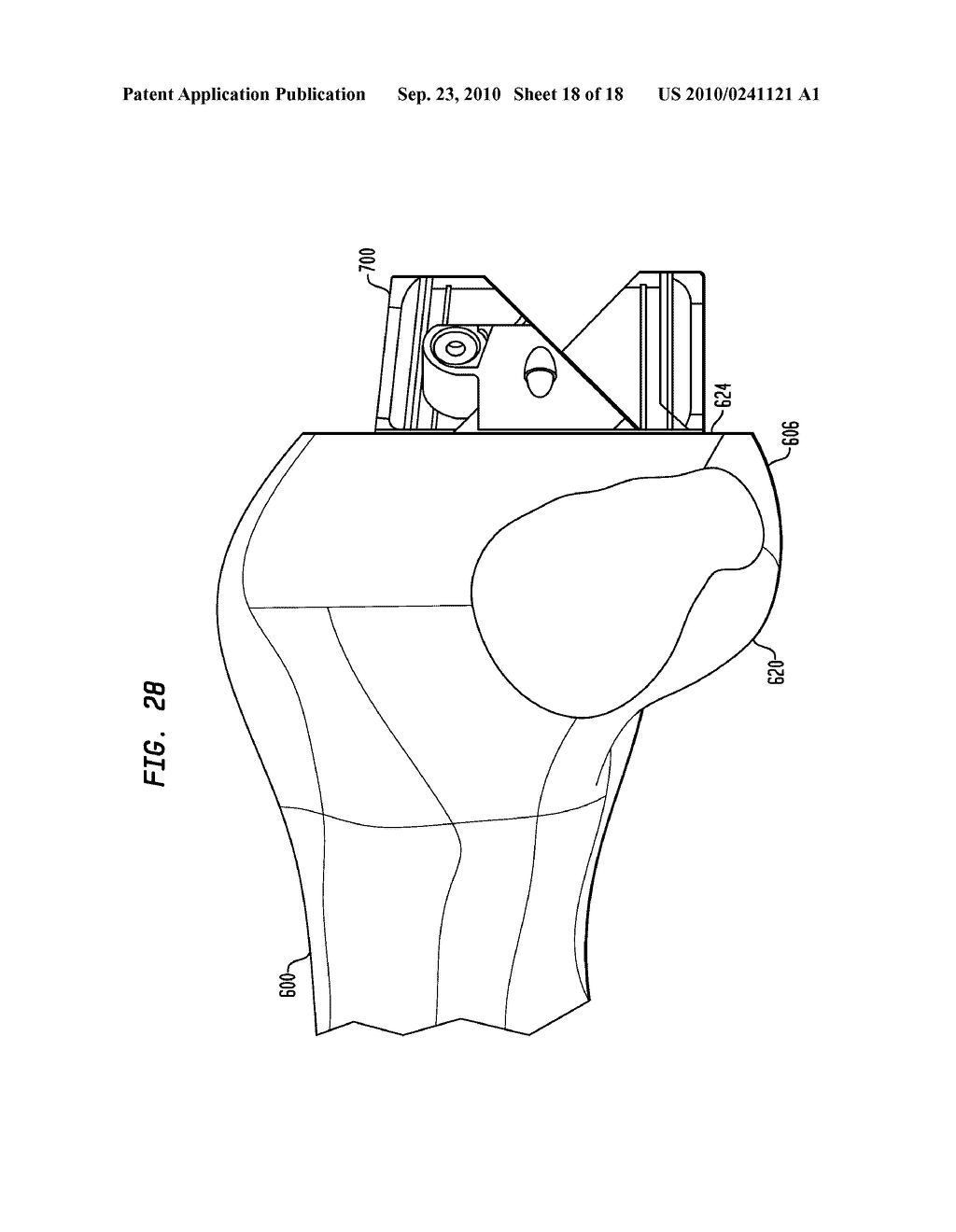 FLEXIBLE INTRAMEDULLARY ROD - diagram, schematic, and image 19