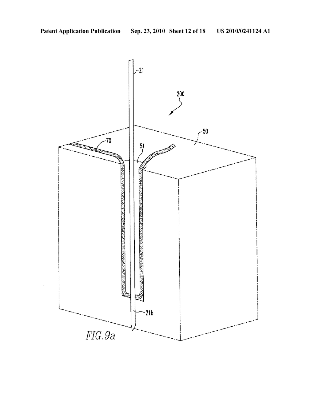 Soft Tissue Manipulator Assembly - diagram, schematic, and image 13