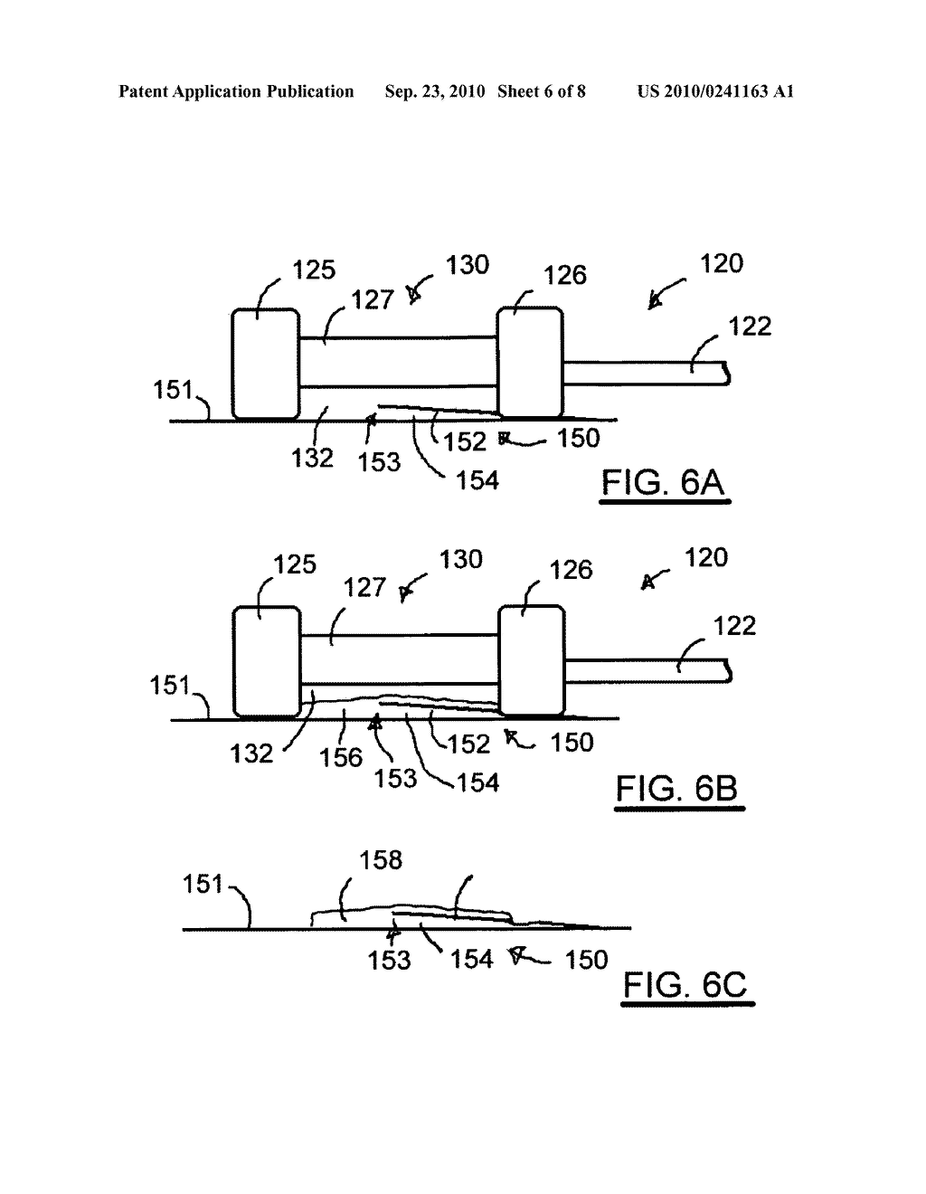 Aortic Dissection Treatment System and Method of Use - diagram, schematic, and image 07