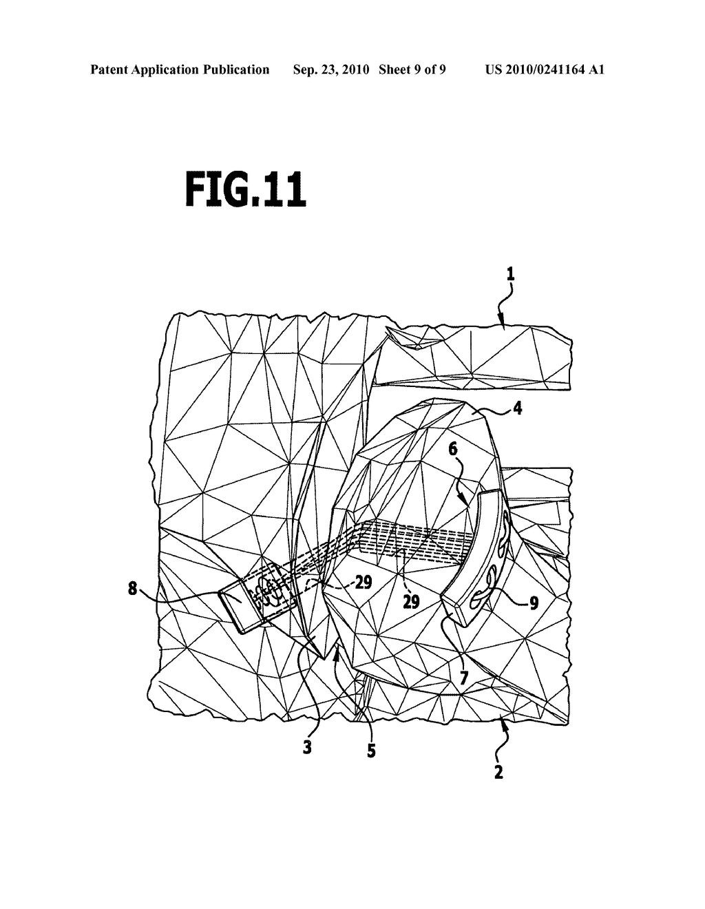 Facet joint implant - diagram, schematic, and image 10